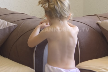 Jarës 4 vjeçare i duhet ndihmë për mjekimin e kurrizit (Video)