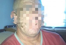 Ngjarje e rëndë në Mitrovicë, dyshohet se babai dhunoi seksualisht vajzën e tij