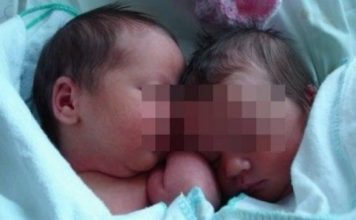 Binjakët në Itali, njëri në vitin 2018, tjetri më 2019