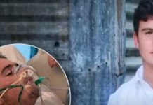 17 vjeçari në gjendje të rëndë, tymosi cigare elektrike