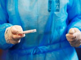 Shkon në 16 numri i të vdekurve nga Covid-19 në Shqipëri