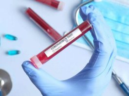 15 raste të reja me koronavirus në Shqipëri, shkon numri në 212