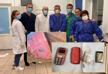 Flet mjeku që ia hoqi 33-vjeçarit telefonin nga barku: Kishte rrezik të shpërthente bateria