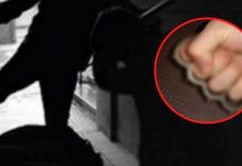 Dy persona bëjnë llom 31-vjeçarin, ia thyejnë hundën duke e goditur me boks të hekurit