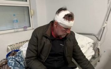 “Ma ngacmoi motrën 13-vjeçare”: Dalin detaje nga rrahja e mësuesit