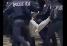 I thyen këmbën, i riu në Tiranë: S’kisha lidhje fare me protestën
