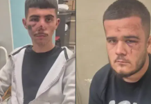 Ngjarje e rëndë në Shkup, dy të rinj dyshohet se u rrahën brutalisht nga Policia